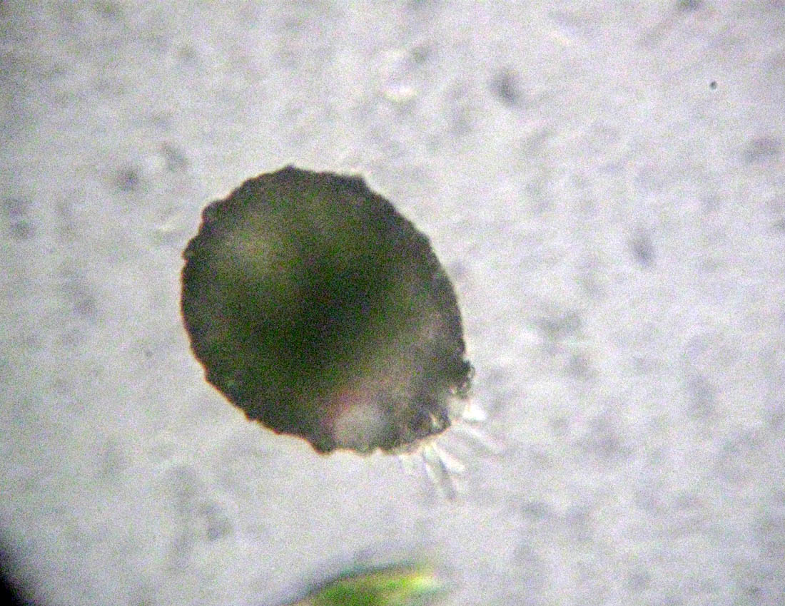 Difflugia verosimilmente gramen